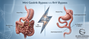 Mini Gastrik Bypass ile Klasik Bypass Farkı: Hangisi Kime Uygun?